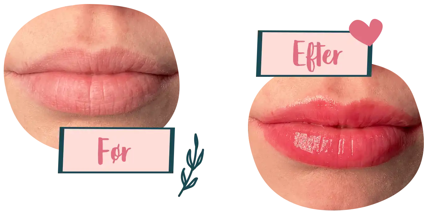 lever Humanistisk Konsekvent Naturligt større læber med lip plumpers | Læbepleje | Lipgloss | rossmann.dk lever Humanistisk Konsekvent Naturligt større læber med lip plumpers | Læbepleje | Lipgloss | rossmann.dk